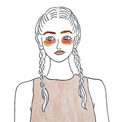 【黒クマ】は美容医療に頼るべき!? セルフチェックPOINT4つ