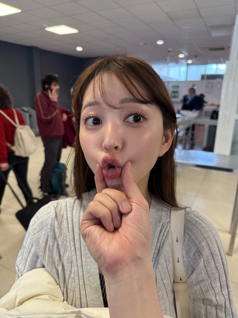麻亜里さん ニキビ肌→美肌へのビフォーアフター
