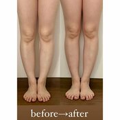 【食事制限なし】10日間で脚やせに成功!? TikTokやYouTubeでバズりまくりの『脚パカソーラン節』にチャレンジした結果がスゴい♡