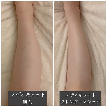 メディキュット8種類をガチ検証 足のむくみを撃退できたのはコレ Arweb アールウェブ