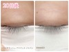 まつ毛美容液を使用して20日が経過。まぶたの変色が落ち着いてきた!