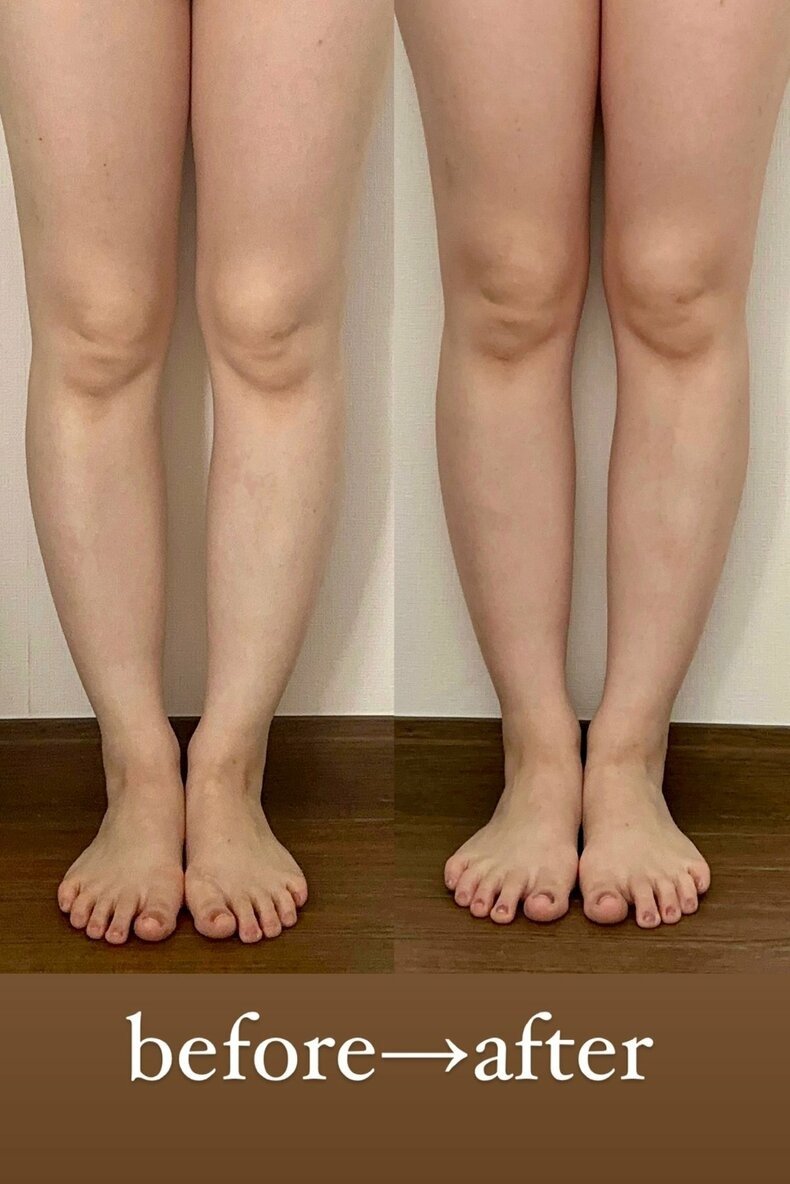 下半身・脚痩せにおすすめの宅トレダイエット arモデルエディター・阿部舞理奈 ビフォーアフター