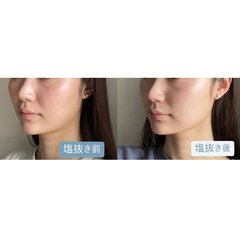 2日間でOK！むくみがとれたすっきりフェイスラインに♡ゆるーく始められる【塩抜きダイエット】をご紹介