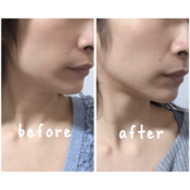 「1日10分で石原さとみの顎をゲトれる！？」可愛い顔は自分で作れるか、ガチ検証！