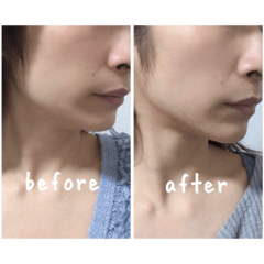 「1日10分で石原さとみの顎をゲトれる！？」可愛い顔は自分で作れるか、ガチ検証！