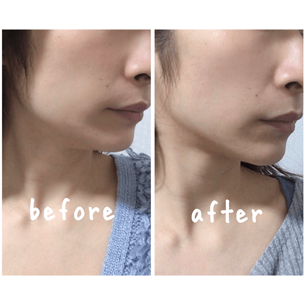 「1日10分で石原さとみの顎をゲトれる！？」可愛い顔は自分で作れるか、ガチ検証！