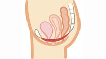 【おすすめ膣トレ！】骨盤底筋のトレーニングで、ぐらぐら尿道を引き締めて
