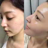 「昔は1日1個新しい吹き出物ができる感じで…」肌が変わったのは食事改善がキッカケ！遅延型アレルギー検査についてなどモデル・麻亜里の人生を変えたビジュ上げテクを大公開