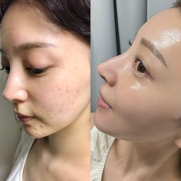 「昔は1日1個新しい吹き出物ができる感じで…」肌が変わったのは食事改善がキッカケ！遅延型アレルギー検査についてなどモデル・麻亜里の人生を変えたビジュ上げテクを大公開