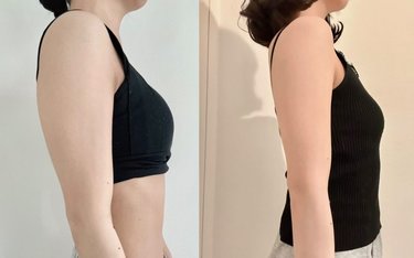 二の腕痩せダイエット】太る原因は？痩せるには？－10㎝などに成功した