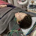 麻亜里さん「美容鍼で横皺が出来にくくなった」