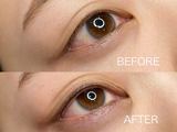 アイラインアートメイクを編集部員がやってみた結果…もうすっぴんが怖くない!?クリニックの選び方、痛みやダウンタイムの状態もお届け【体験レポ】