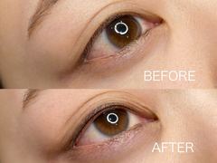 アイラインアートメイクを編集部員がやってみた結果…もうすっぴんが怖くない!?クリニックの選び方、痛みやダウンタイムの状態もお届け【体験レポ】