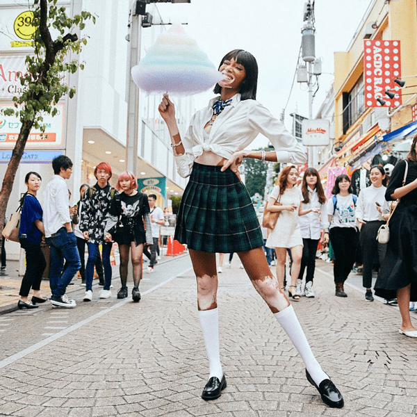 世界にたった一人の美女！ まだら肌のスーパーモデル、ウィニー・ハーロウに美の秘訣を聞いてみた