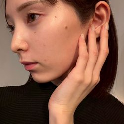 モデル橋下美好「高価な化粧品を試すこともありましたが…」ニキビ肌改善の秘密は発酵食品!? おすすめのサプリからデトックスレシピまでご紹介