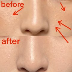 【5日間チャレンジ】腸もみ×白湯で-1.2kg！　さらに美肌効果も♡