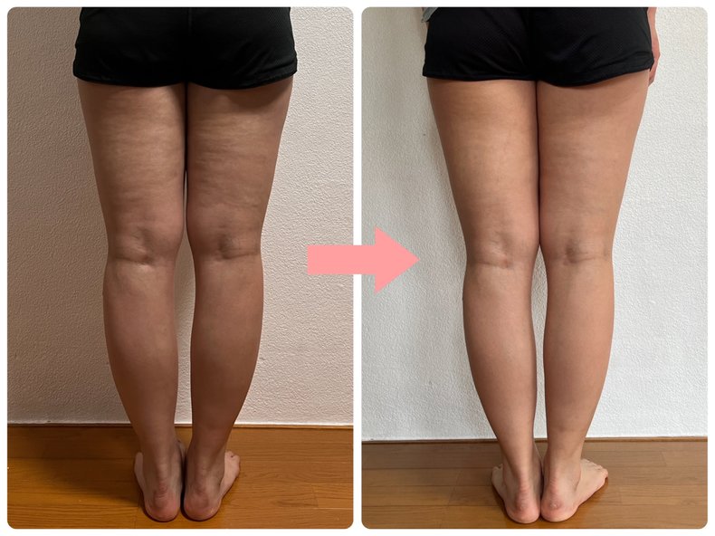 脚痩せダイエット 結果 ビフォーアフター画像