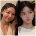 ほうれい線が目立ちにくく!(左)施術前/(右)施術後