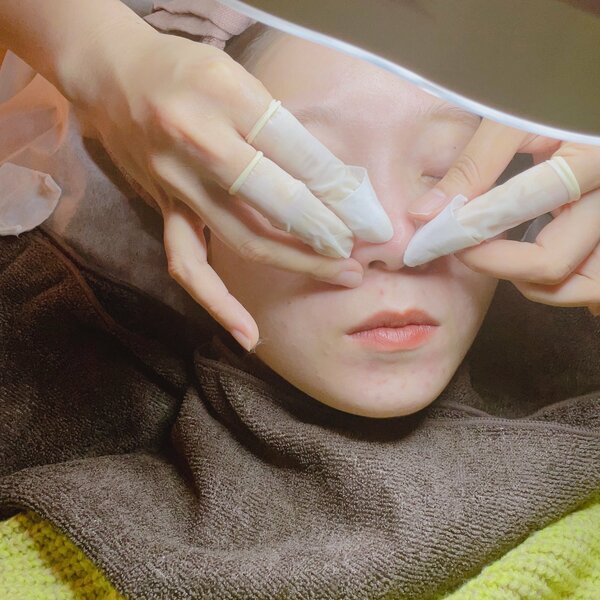 毛穴洗浄の効果って？エステでできる毛穴ケアを体験レポ！毛穴が詰まる原因やおすすめサロンもご紹介