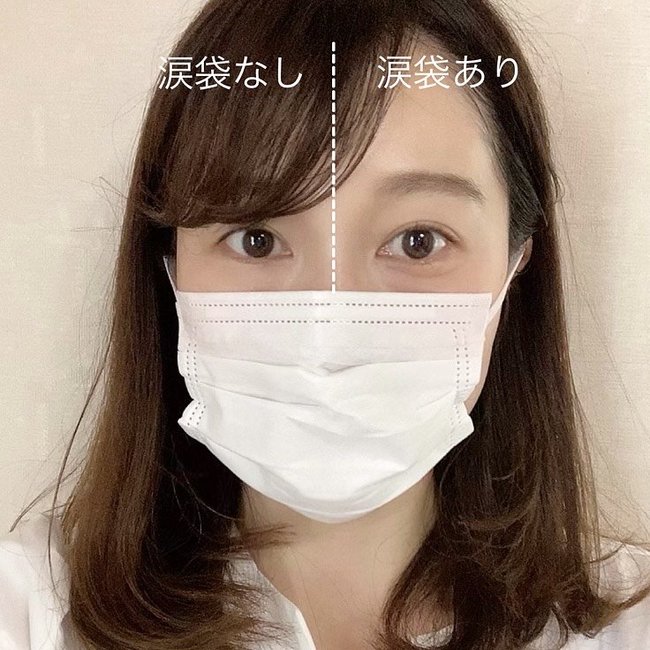 「涙袋があるとないとでここまで違う！」自然に盛れる3ステップ