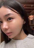 美容医療と日頃のケアのおかげで透明感爆誕!