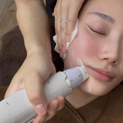 「3つの中で1番良かった！」フェイスラインを引き締めてスタイルアップ♡私が受けた【高周波治療3つ】を徹底解説