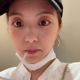 「10年悩んだ"そばかす"が無くなった！」レーザー治療の効果や金額、驚いたことを簡単レポ♡