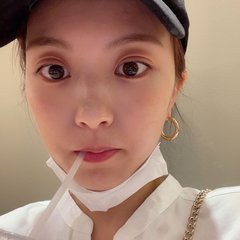 「10年悩んだ"そばかす"が無くなった！」レーザー治療の効果や金額、驚いたことを簡単レポ♡