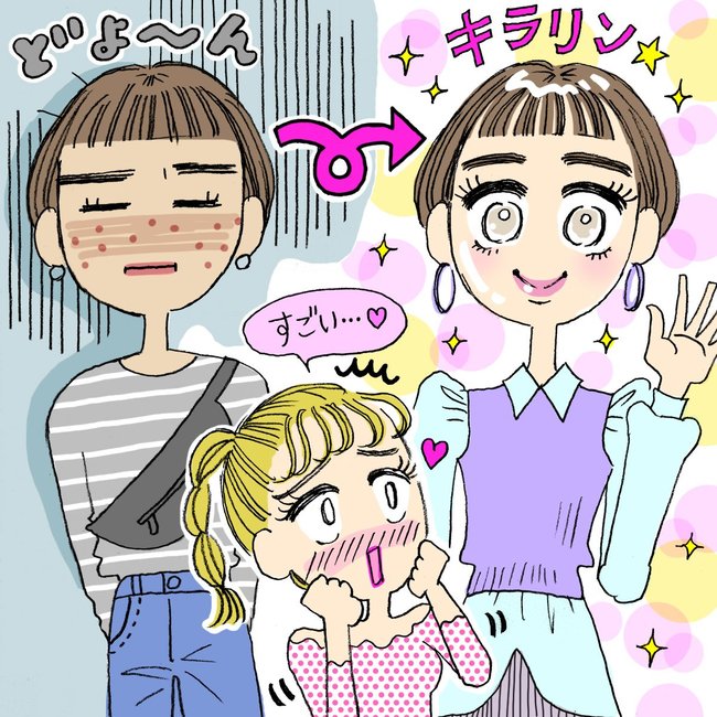 「昔は肌荒れしてたのになんで!?」久々に会った友達が『ダーマペン』で美女化していた話