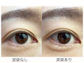 涙袋あり・なし比較画像