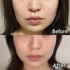 顔の余白が増え続ける編集部員が【1日6分小顔マッサージ】を7日間続けてみた