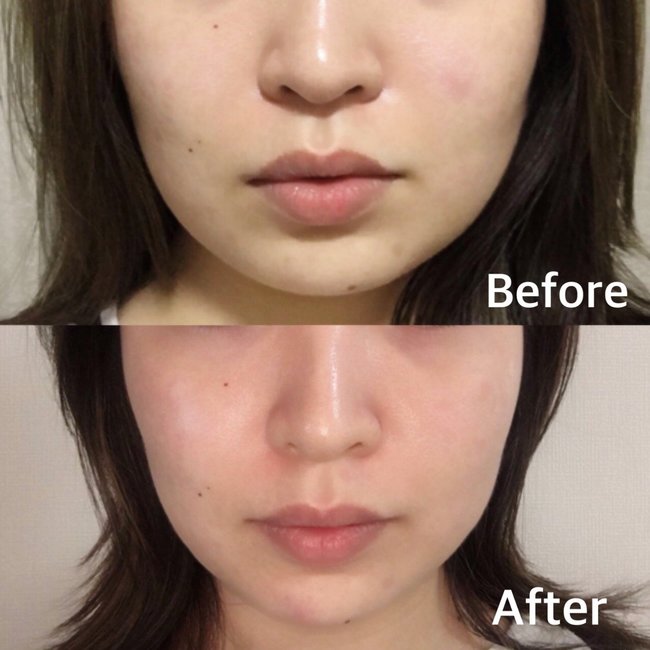 顔の余白が増え続ける編集部員が【1日6分小顔マッサージ】を7日間続けてみた