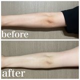 「私の肘、こんなに黒かったっけ？」フィルターなしでこの違い！肘の黒ずみに絶望したOLが1週間本気で腕ケアしたら驚きの結果に
