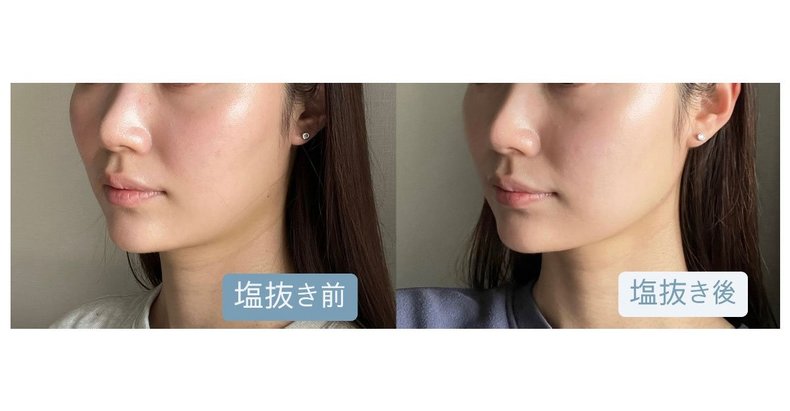 2日間でOK！むくみがとれたすっきりフェイスラインに♡ゆるーく始められる【塩抜きダイエット】をご紹介