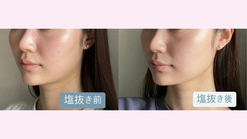 むくみとは?原因は何?解消を目指す対策法を薬剤師が解説! ar界隈の顔や足のリアルなむくみケアも必見♡
