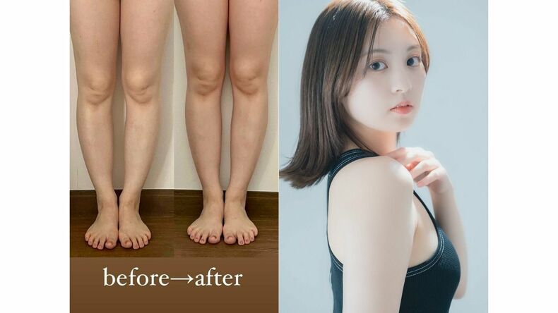 【10日間ダイエット】見た目は変わる？簡単ゆるジャンプ＆脚パカソーラン節のリアル体験談やビフォーアフターも♡