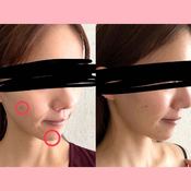 【腸活】”ひと晩発酵みそ”の作り方は？美容やダイエット効果はある？ライターが7日間試してみた【レシピも公開】