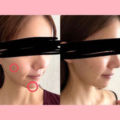 【腸活】”ひと晩発酵みそ”の作り方は？美容やダイエット効果はある？ライターが7日間試してみた【レシピも公開】