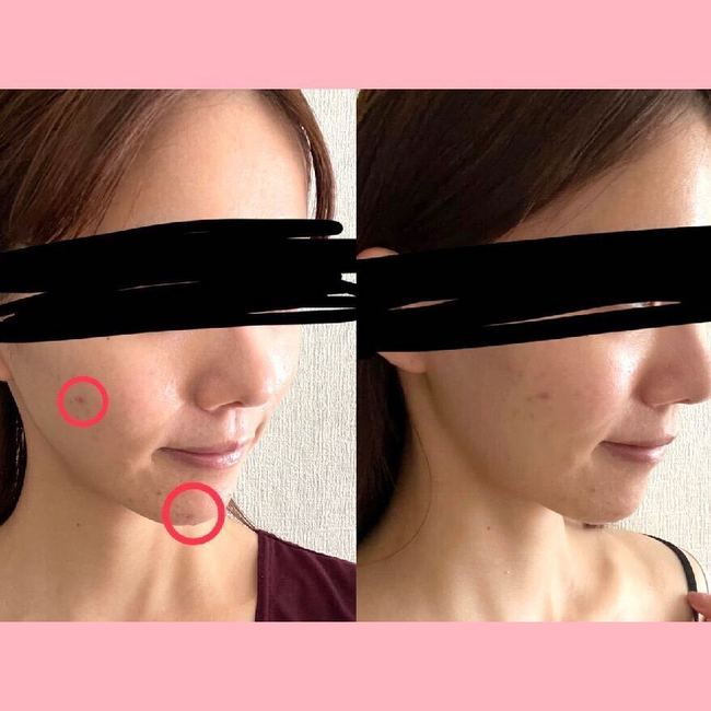 【腸活】”ひと晩発酵みそ”の作り方は？美容やダイエット効果はある？ライターが7日間試してみた【レシピも公開】