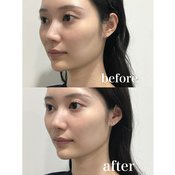 「細かいシミが気になり始めた…」初めての美容医療を現役美容ナースが指南！おすすめ美容医療3選