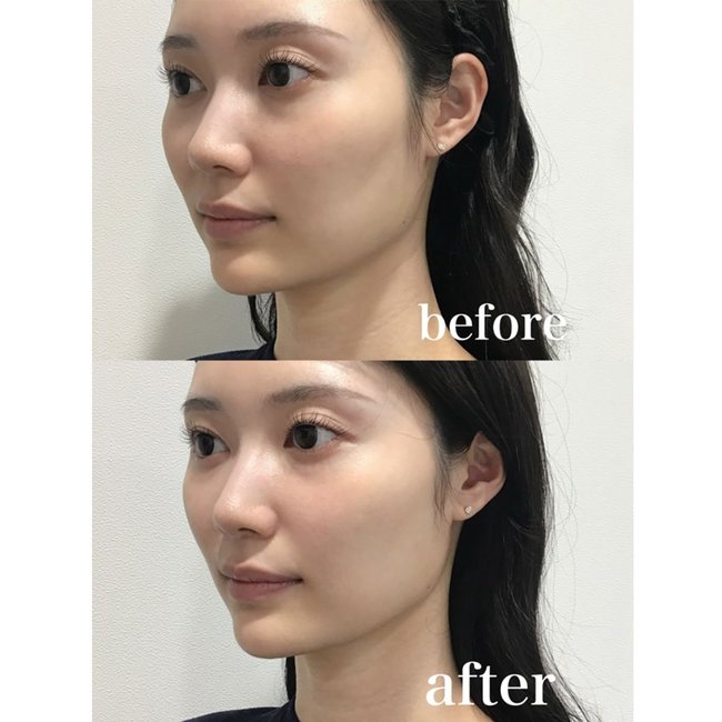 「細かいシミが気になり始めた…」初めての美容医療を現役美容ナースが指南！おすすめ美容医療3選