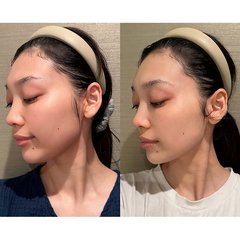 「たった1週間で小顔になれる!?」激しい運動や食事制限は一切ナシ！手軽で今すぐに実践できちゃう【最強小顔術３選】